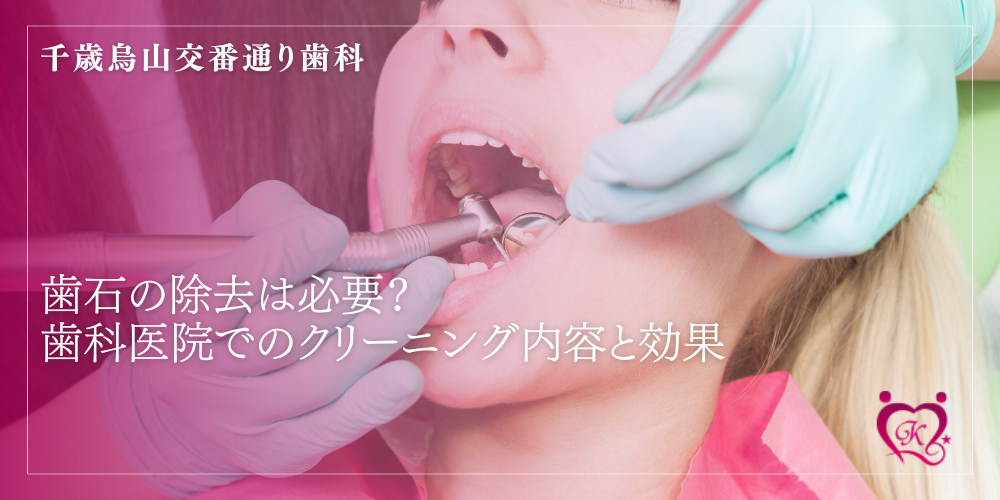 歯石の除去は必要?歯科医院でのクリーニング内容と効果