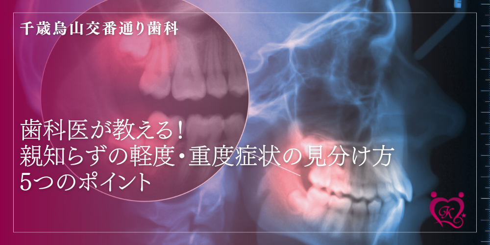 歯科医が教える!親知らずの軽度・重度症状の見分け方5つのポイント