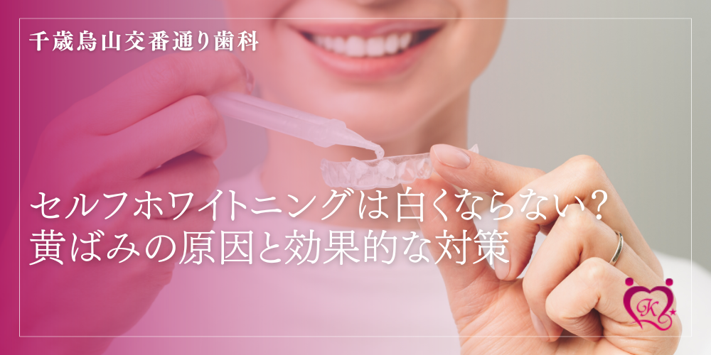 セルフホワイトニングは白くならない？黄ばみの原因と効果的な対策