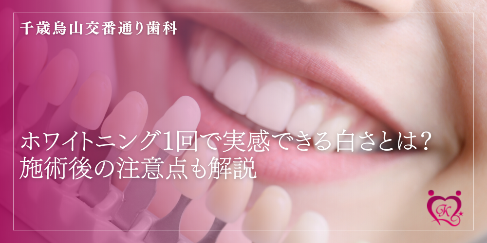 ホワイトニング1回で実感できる白さとは？施術後の注意点も解説