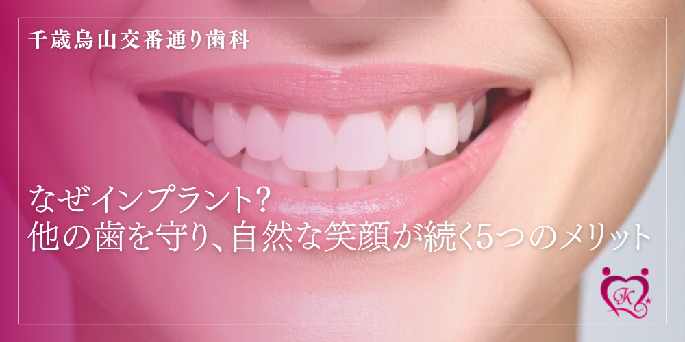 なぜインプラント？他の歯を守り、自然な笑顔が続く5つのメリット